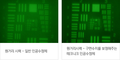 리줌 멀티포컬 인공수정체 시력