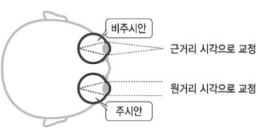 커스텀뷰 노안교정술 개요