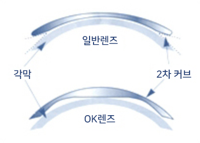 드림렌즈