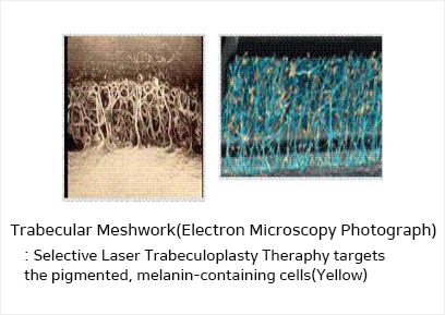 Trabecular Meshwork